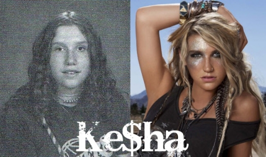 kesha-nose-job1.jpg