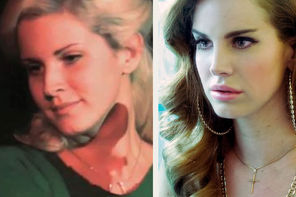 lana-del-rey-plastic-surgery-nose-i2.jpg